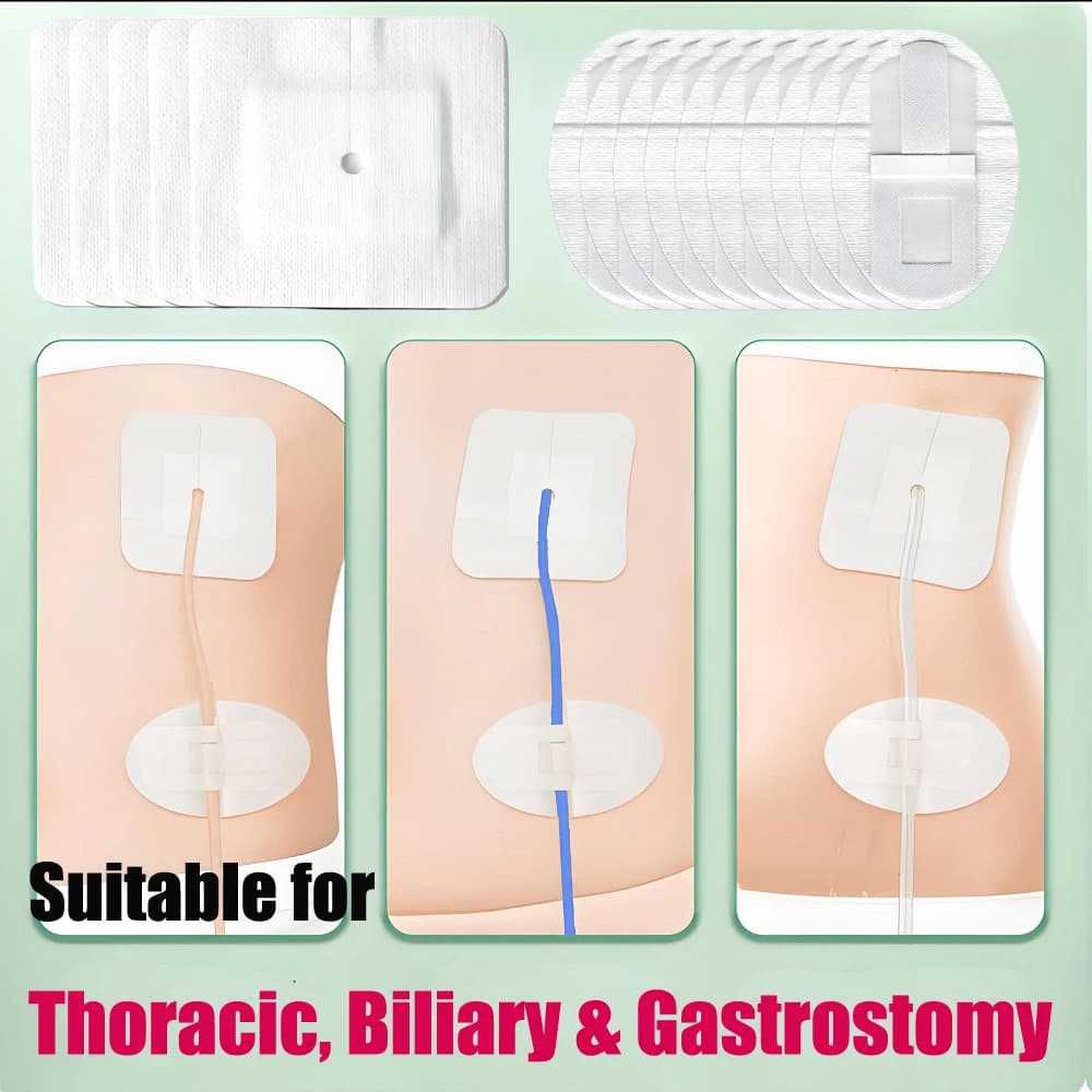 Parche de fijación de catéter aplicador estéril de tubo de drenaje de 5-100 Uds para parches adhesivos de catéteres de biopsia/biliaria/renal