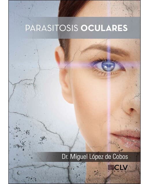 Parasitosis oculares (Tapa blanda).