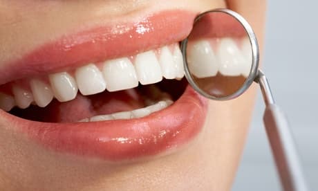 2 sesiones de blanqueamiento dental led limpieza bucal con ultrasonidos fluorización pulido y revisión