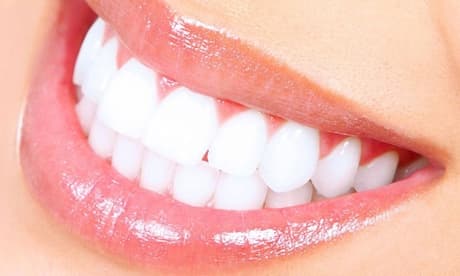 Limpieza bucal con ultrasonidos fluorización pulido revisión diagnóstico y radiografía