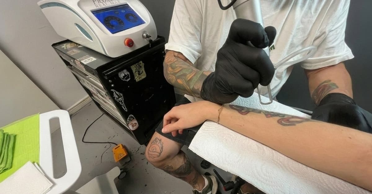 Eliminación de tatuajes láser 3 o 6 sesiones hasta 5 o 10 cm²