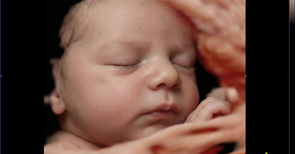 Visualiza a tu bebé: ecografía 8K o para descubrir el sexo del bebé