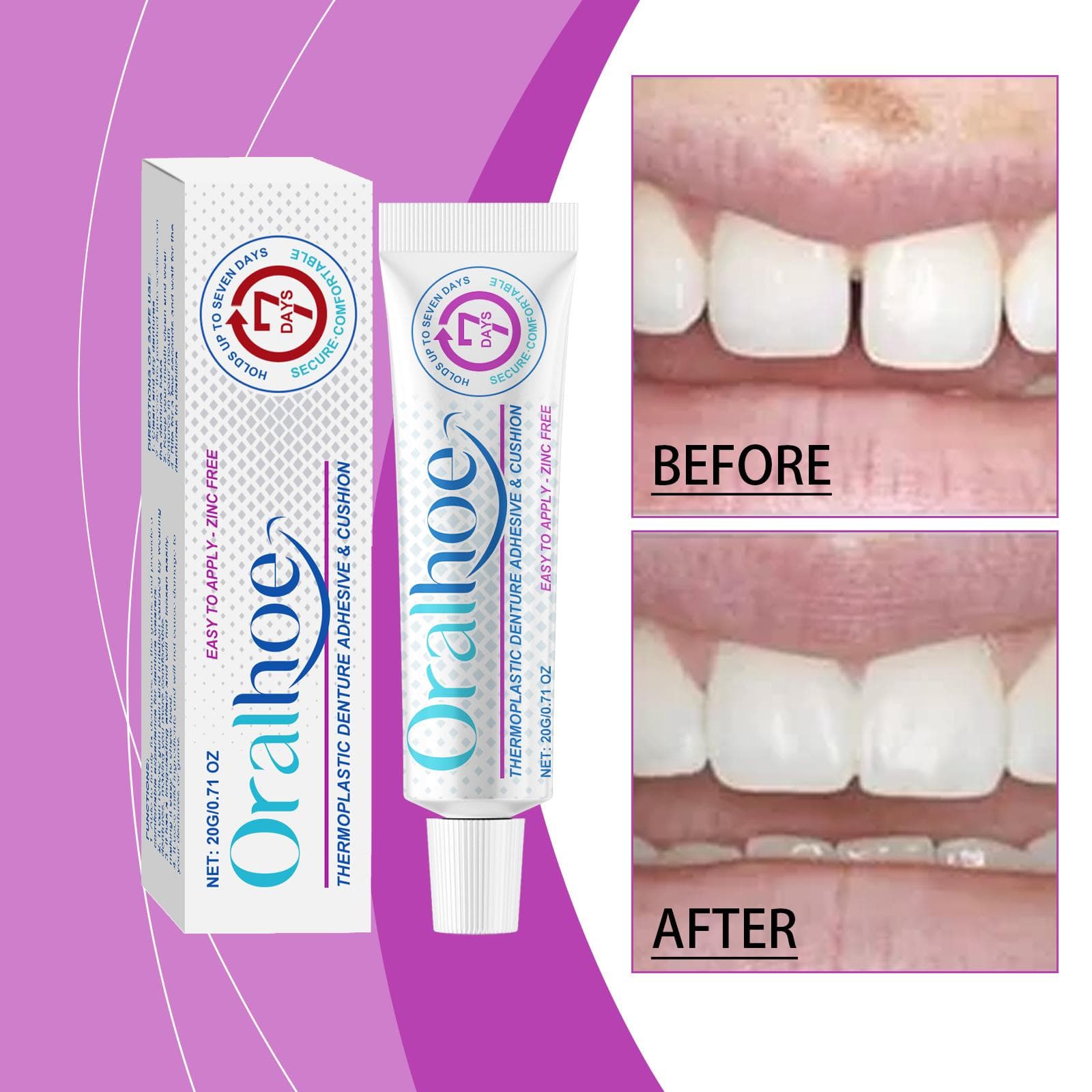 Adhesivo Fijador para Prótesis Dental Oralhoe Adhesivo Termoplástico para Prótesis Dental Fija Prótesis Dentales para Mayor Comodidad