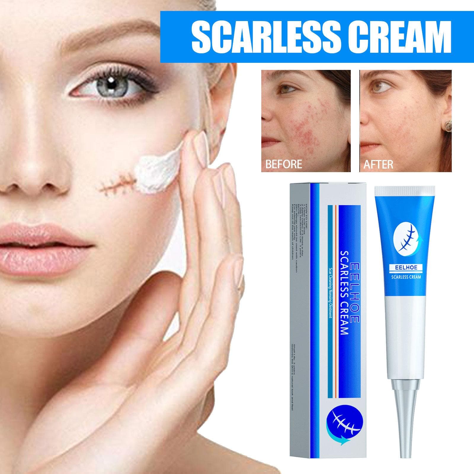 EELHOE Crema para eliminar cicatrices de acné, Gel para el cuidado de la piel, estrías, elimina las manchas de acné, tratamiento de cicatrices